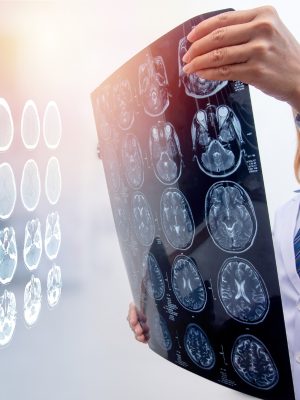 doctor holding MRI film to diagnosis injury area of brain with double exposure of brain CT scan